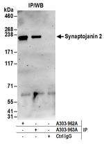Synaptojanin 2 Antibody in Immunoprecipitation (IP)
