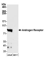 Androgen Receptor Antibody in Western Blot (WB)