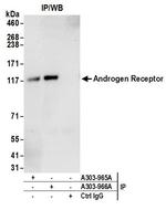 Androgen Receptor Antibody in Immunoprecipitation (IP)