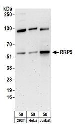 RRP9 Polyclonal Antibody