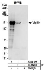 Vigilin Antibody in Immunoprecipitation (IP)