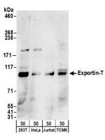 Exportin-T Polyclonal Antibody