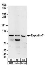 Exportin-T Polyclonal Antibody
