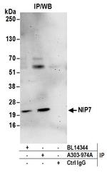 NIP7 Antibody in Immunoprecipitation (IP)