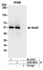Sec62 Antibody in Immunoprecipitation (IP)