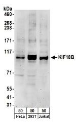 KIF18B Polyclonal Antibody