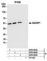 DAZAP1 Antibody in Immunoprecipitation (IP)