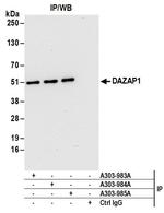 DAZAP1 Antibody in Immunoprecipitation (IP)