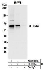 EDC3 Antibody in Immunoprecipitation (IP)