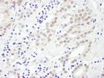 EXOSC10 Polyclonal Antibody
