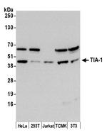 TIA-1 Polyclonal Antibody