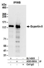 Exportin-5 Antibody in Immunoprecipitation (IP)