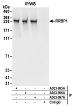 RRBP1 Antibody in Immunoprecipitation (IP)