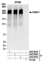RRBP1 Antibody in Immunoprecipitation (IP)