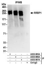 RRBP1 Antibody in Immunoprecipitation (IP)