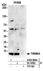 TIMM8A Polyclonal Antibody