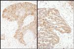 TS Polyclonal Antibody