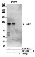 Dab2 Antibody in Immunoprecipitation (IP)