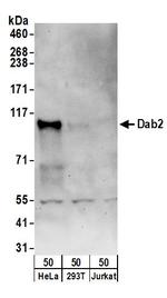Dab2 Polyclonal Antibody