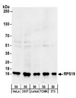 RPS19 Polyclonal Antibody