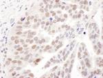 PolD1 Polyclonal Antibody