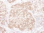 PolD1 Antibody in Immunohistochemistry (Paraffin) (IHC (P))