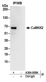 CaMKK2 Antibody in Immunoprecipitation (IP)