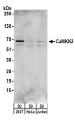 CaMKK2 Antibody in Western Blot (WB)