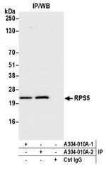 RPS5 Antibody in Immunoprecipitation (IP)