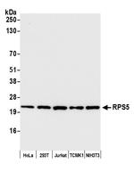 RPS5 Antibody in Western Blot (WB)