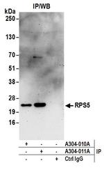 RPS5 Antibody in Immunoprecipitation (IP)