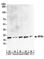 RPS5 Polyclonal Antibody