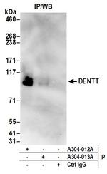 DENTT Antibody in Immunoprecipitation (IP)