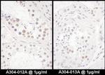 DENTT Antibody in Immunohistochemistry (Paraffin) (IHC (P))