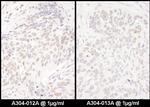 DENTT Polyclonal Antibody