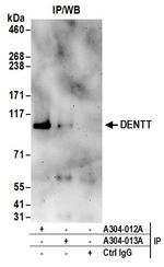 DENTT Antibody in Immunoprecipitation (IP)
