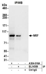 NRF Antibody in Immunoprecipitation (IP)