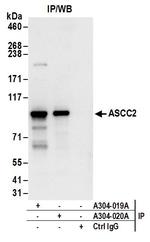 ASCC2 Antibody in Immunoprecipitation (IP)