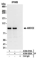 ASCC2 Antibody in Immunoprecipitation (IP)