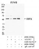 IRF8 Polyclonal Antibody