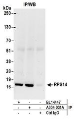 RPS14 Antibody in Immunoprecipitation (IP)