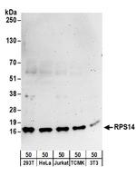 RPS14 Polyclonal Antibody