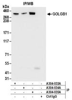 GOLGB1 Antibody in Immunoprecipitation (IP)