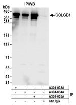 GOLGB1 Antibody in Immunoprecipitation (IP)