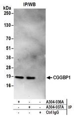 CGGBP1 Antibody in Immunoprecipitation (IP)