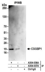 CGGBP1 Antibody in Immunoprecipitation (IP)