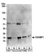 CGGBP1 Polyclonal Antibody