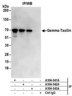 Gamma-Taxilin Antibody in Immunoprecipitation (IP)