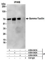 Gamma-Taxilin Antibody in Immunoprecipitation (IP)
