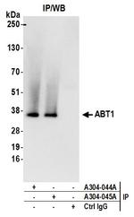 ABT1 Antibody in Immunoprecipitation (IP)